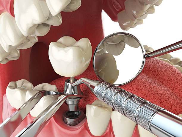 Best Same-Day Emergency Dental Services in Brandywine, MD